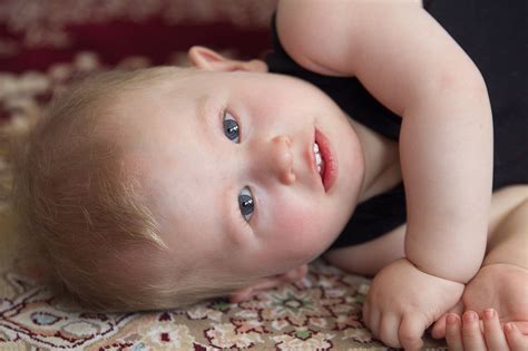 prader willi syndrome toddler